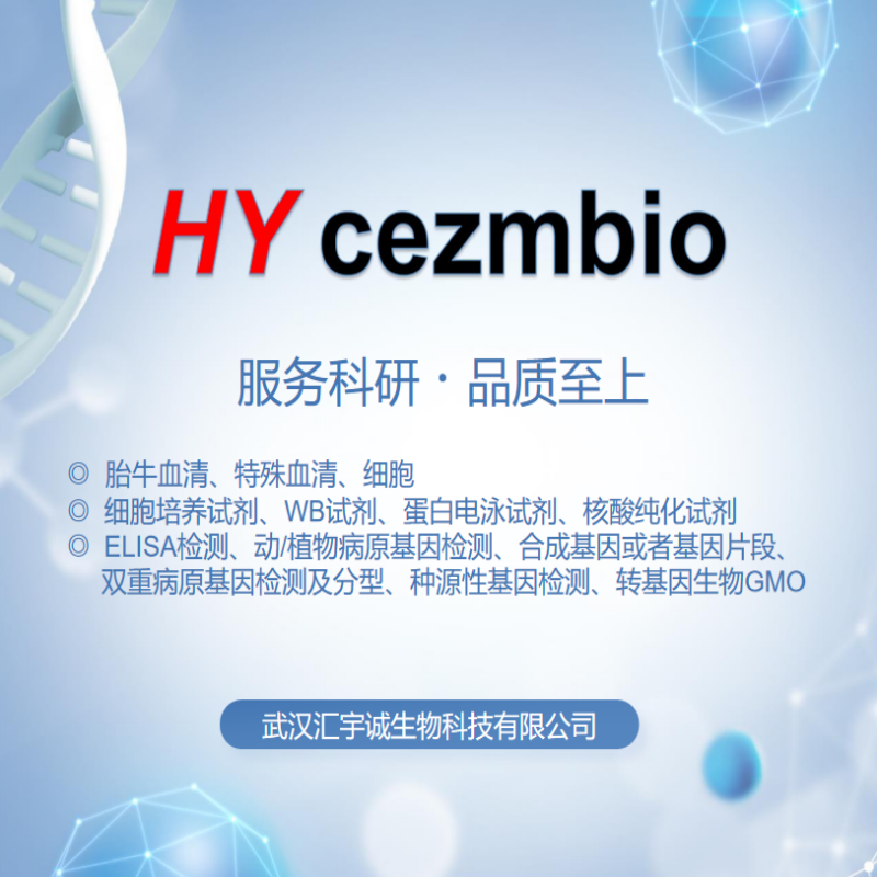 人白细胞介素17受体(IL-17R)ELISA试剂盒